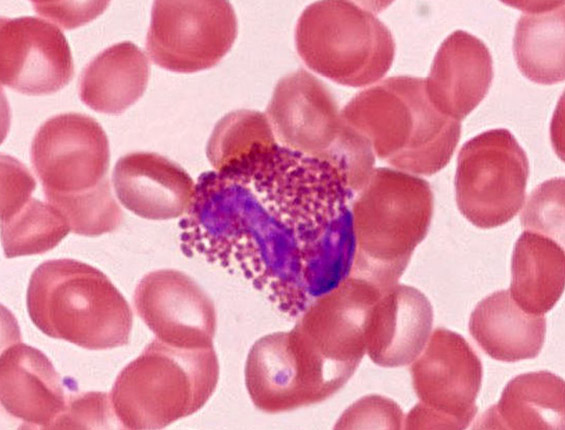 Eosinophil